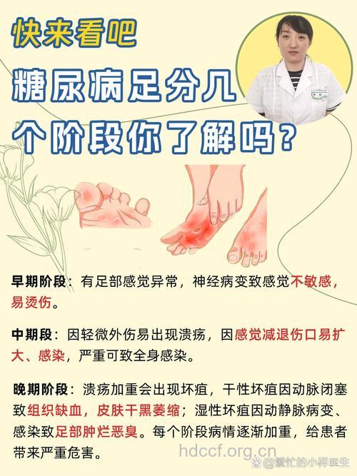 别把误认为糖尿病足老寒腿