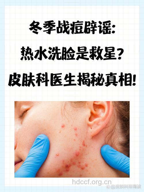 冷水洗脸为什么会导致粉刺