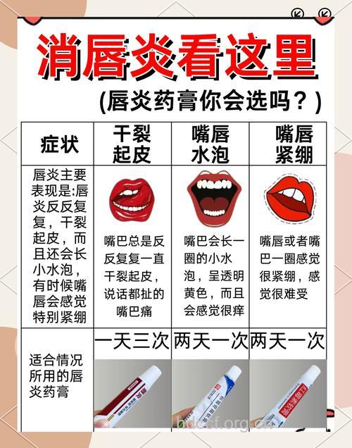 中医治慢性唇炎六偏方