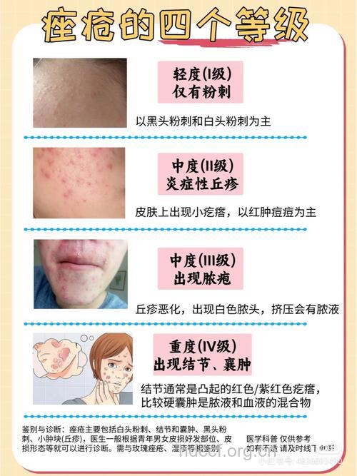 抠“青春痘”有什么危害