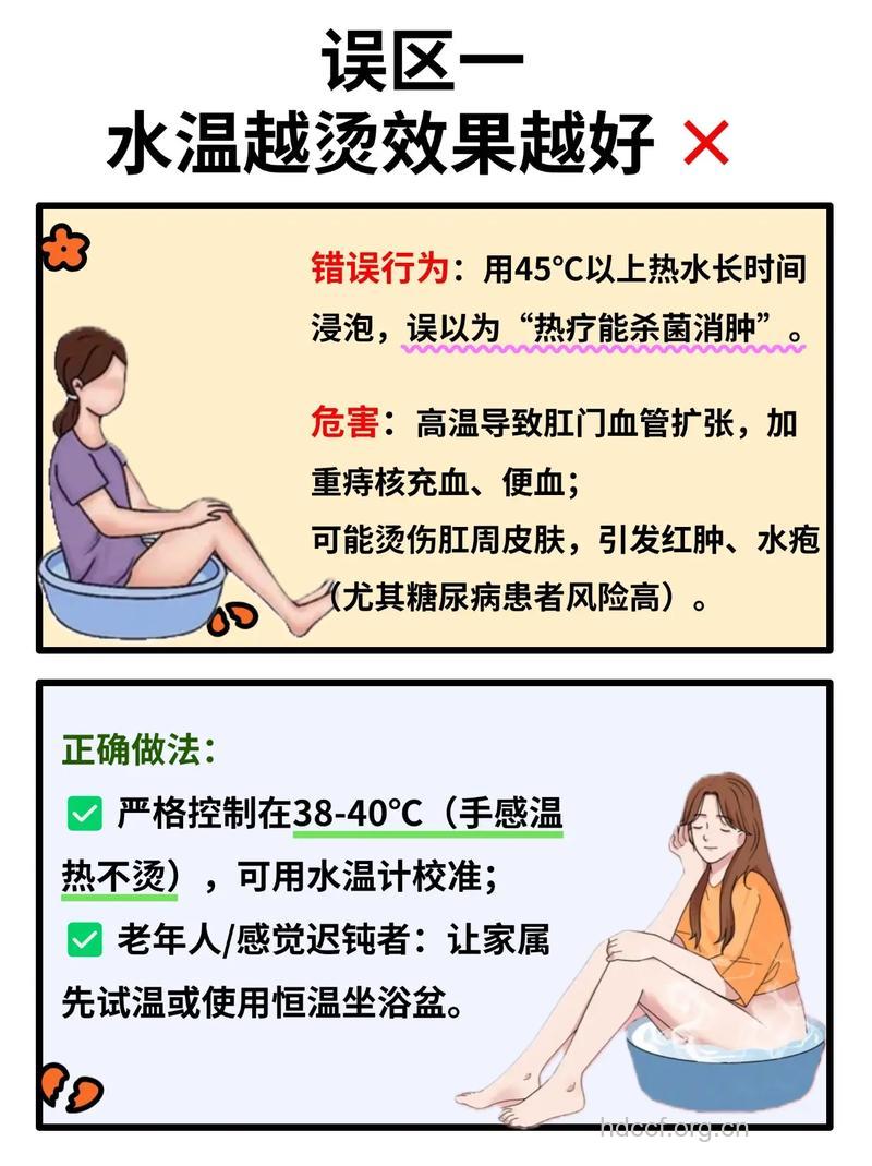温水坐浴能缓解早期内痔吗
