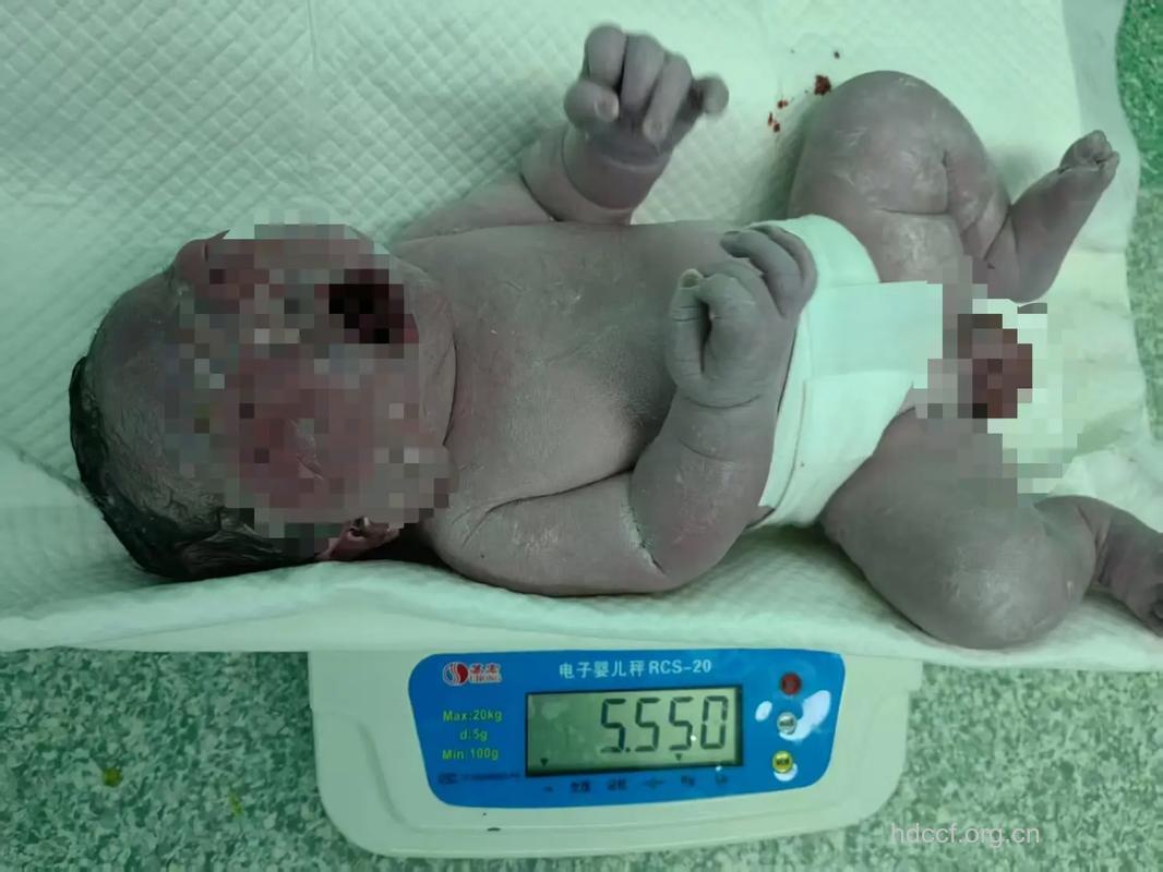 孕妇糖尿病如何生出健康宝宝