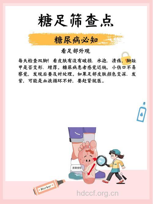 糖尿患者腿脚不便须谨慎应对