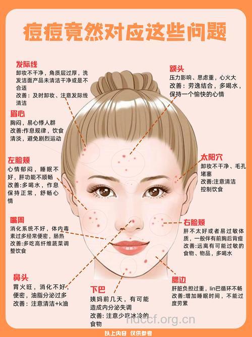 不同部位长痘的的治疗方法不同