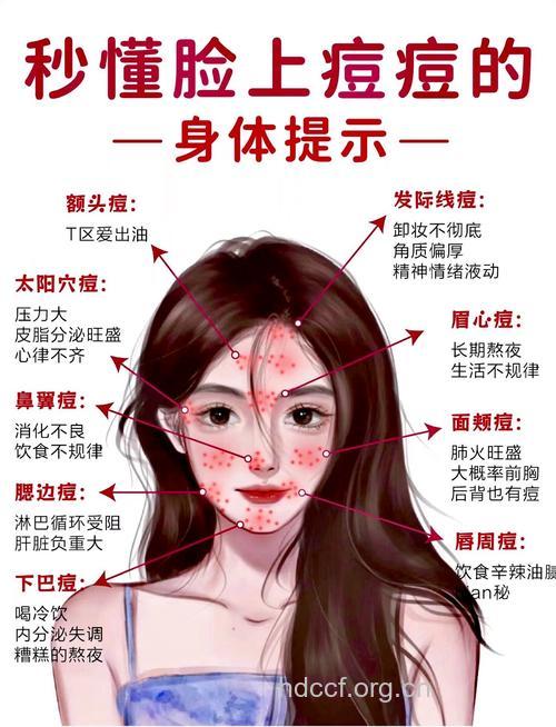 脸上痤疮的诱因有什么