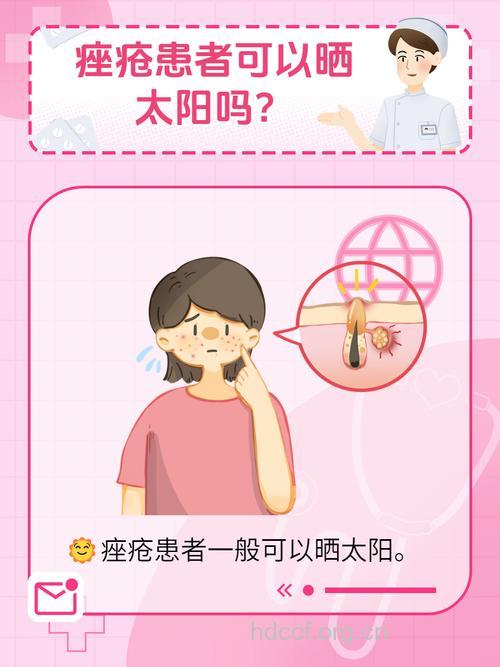 痤疮的发病率为何越来越高