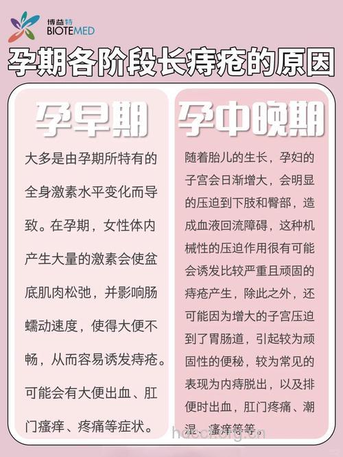 孕妇们为何易得痔疮