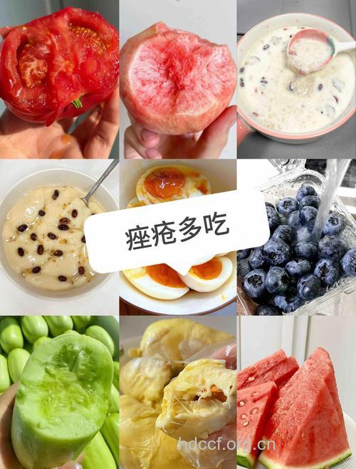 痤疮患者应该多吃什么