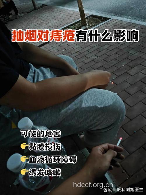 吸烟会引来痔疮吗