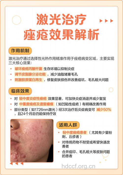 激光治疗痤疮有什么危害