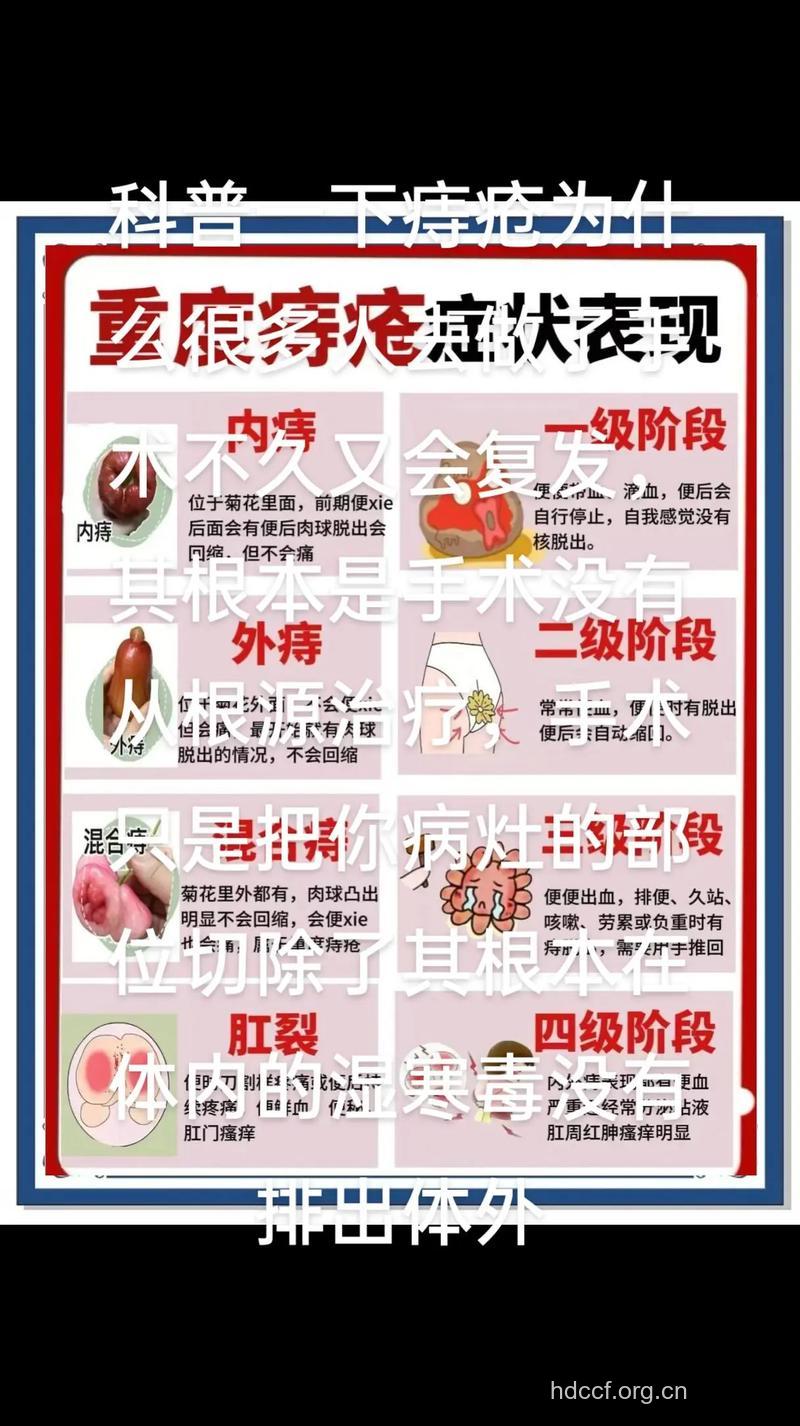 痔疮复发的原因是什么