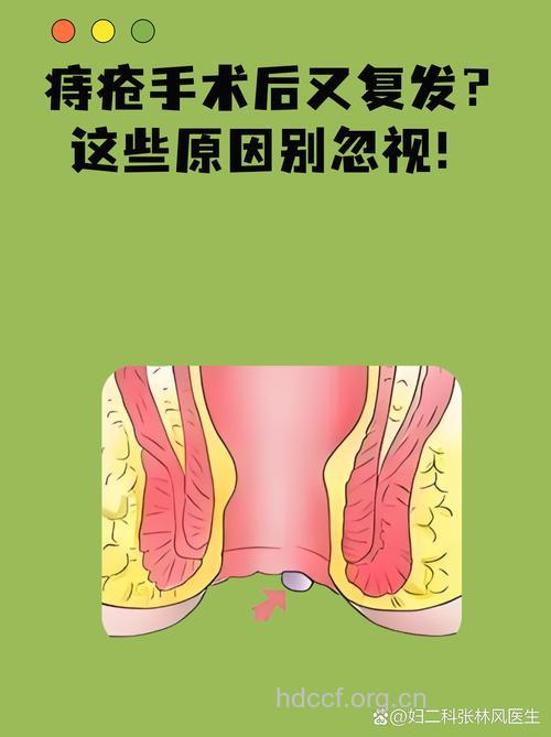 内痔治疗后复发的原因是什么