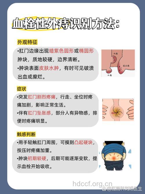 血栓性外痔产生的原因