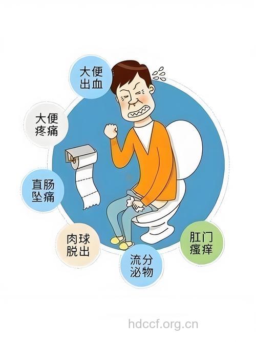 如厕时间长小心痔疮盯上你