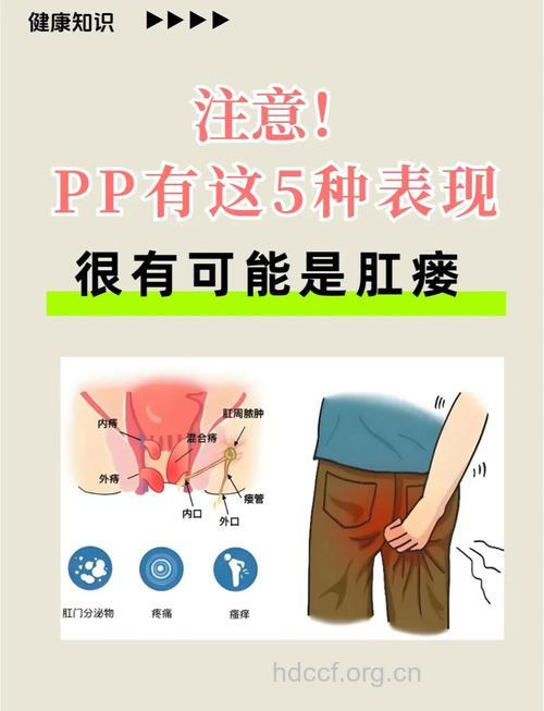 肛瘘有什么症状