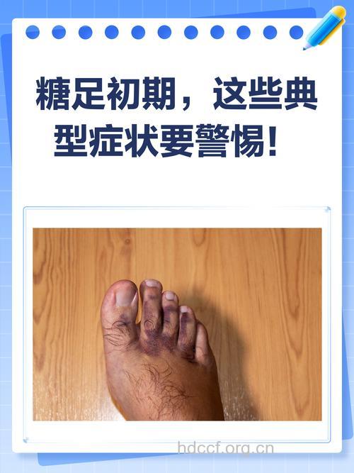 容易缠上糖尿病患者的是病足