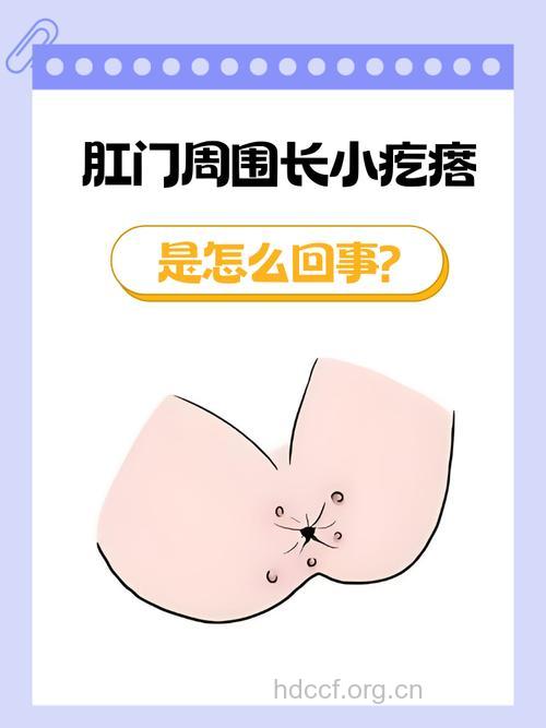 肛门上长了个疙瘩是为什么