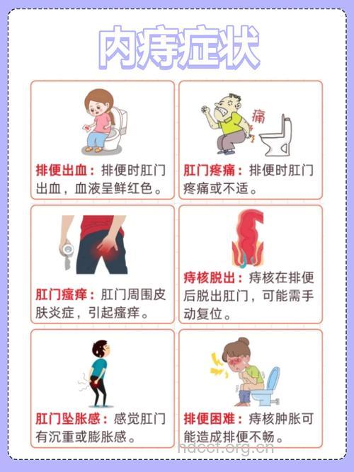 内痔与排便时间有什么关系