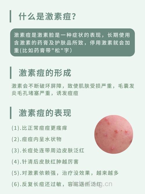 女性痤疮与性激素有关吗