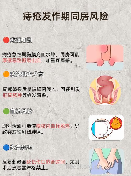 性生活过频也会引发痔疮吗