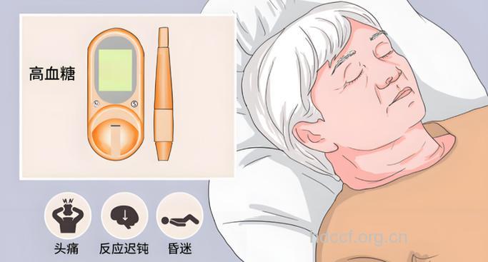 高龄糖尿病患者小心高渗性昏迷