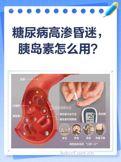 糖尿病高渗性昏迷你知多少