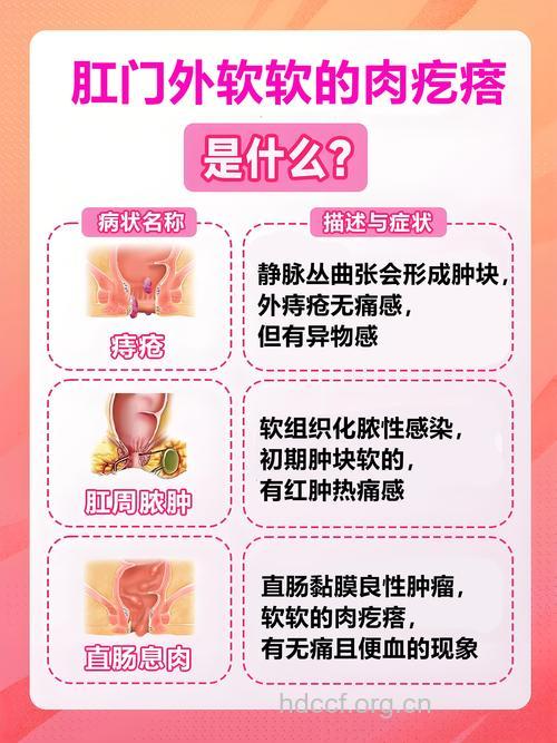 外痔有哪些病因