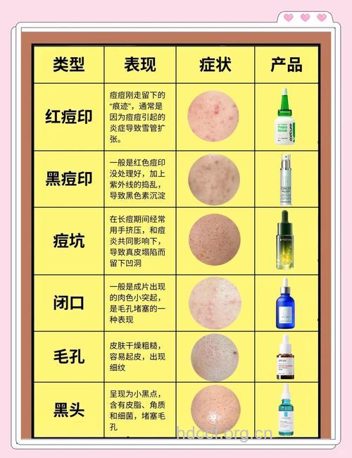 去痘去印的方法