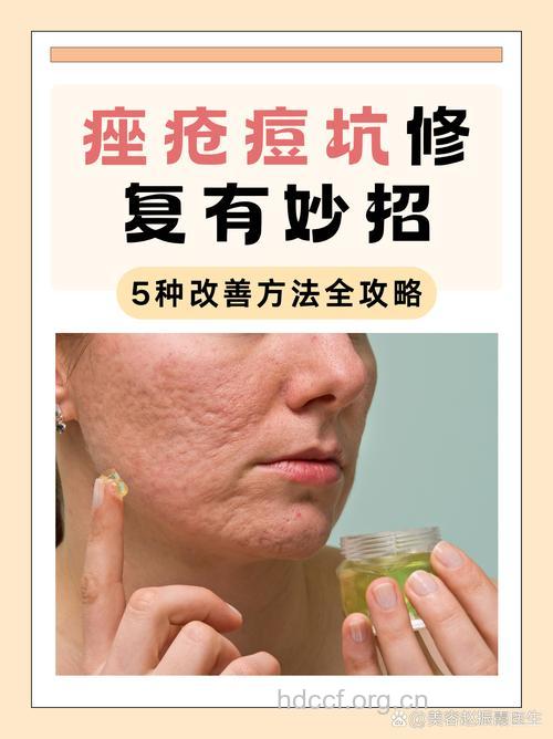 有哪些祛除痤疮疤痕方法