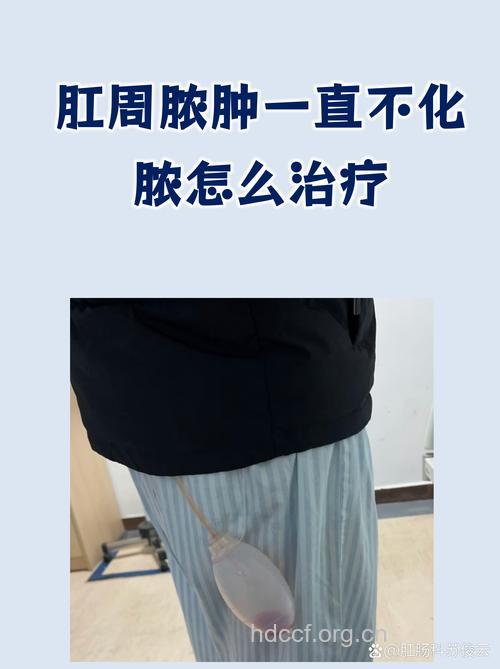 肛周脓肿的超声治疗方法有哪些好处