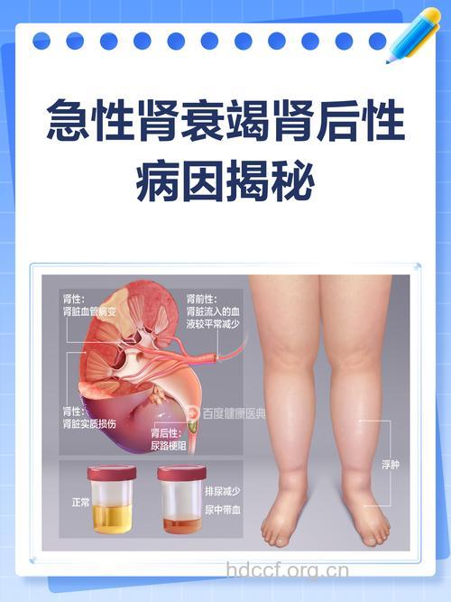 肾衰竭有哪些后遗症