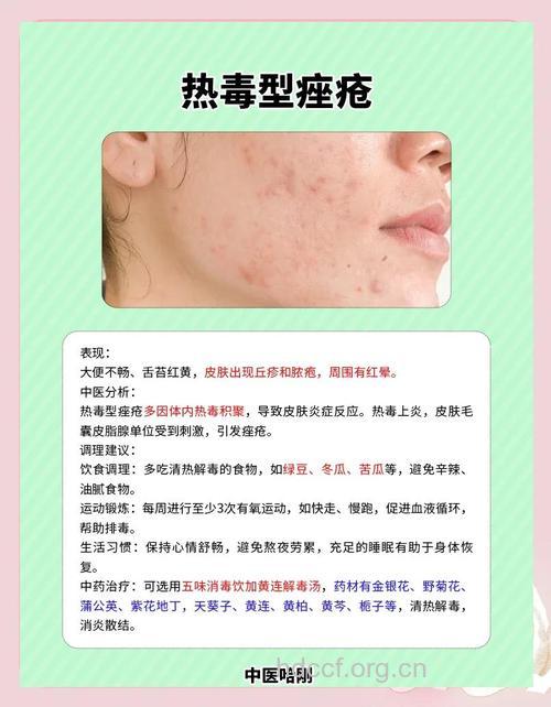 痤疮患者有哪些保健禁区