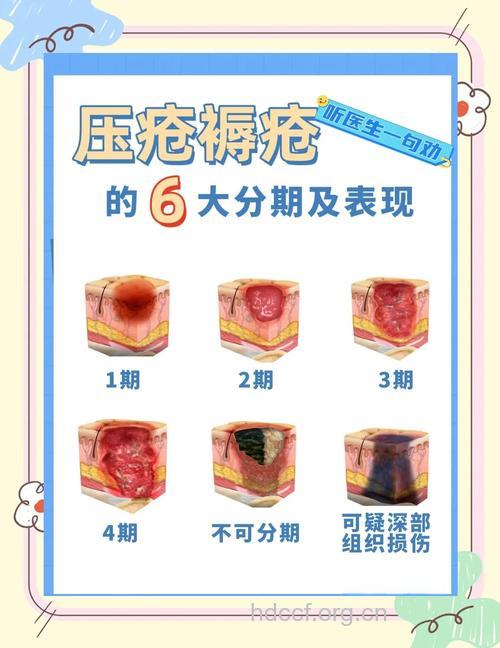 褥疮有哪些症状表现