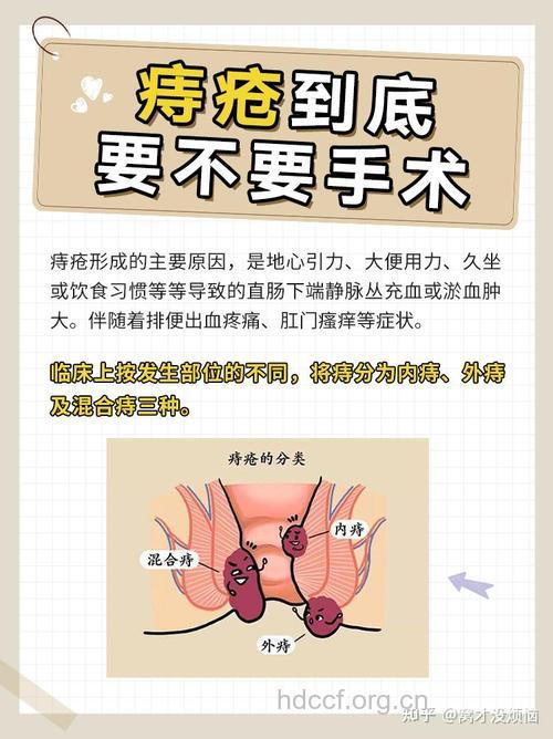 孕妇得痔疮能做手术吗