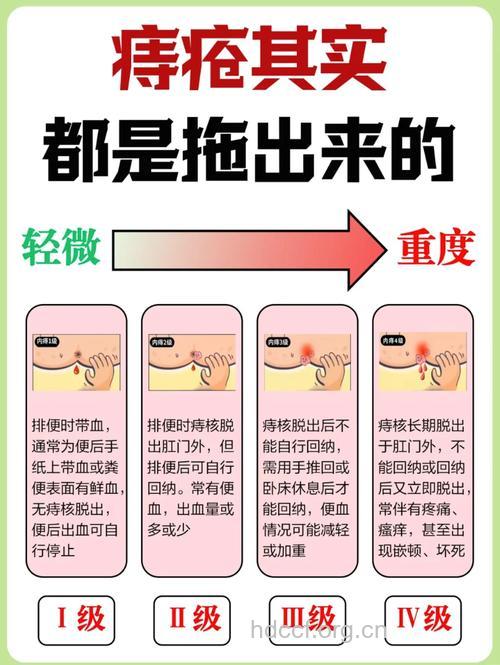 关于外痔疮的危害和治疗方法