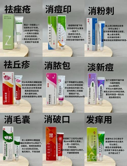治疗痤疮的药物有哪些