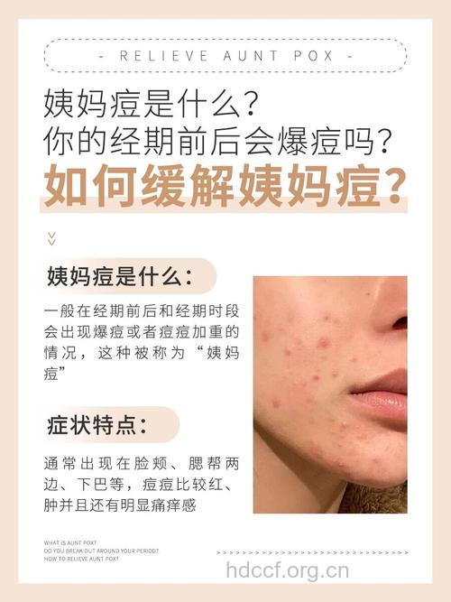 女性生理期为何反复长痘