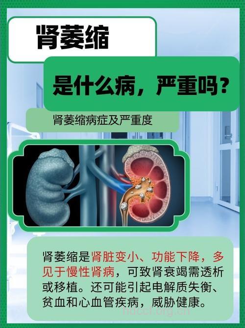 谨防糖尿病引起的肾萎缩