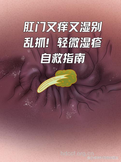 肛周湿疹为何状？