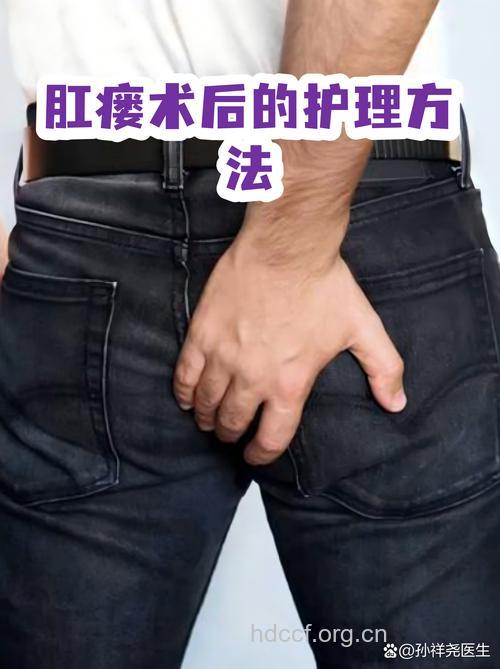 肛瘘的术后处理