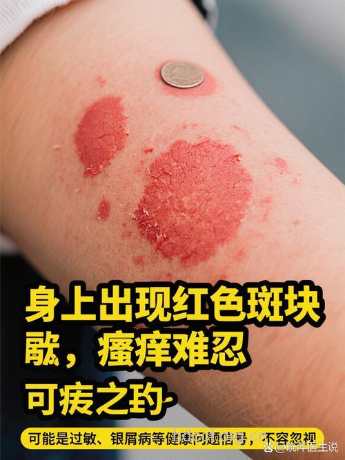 皮肤变色小心疾病