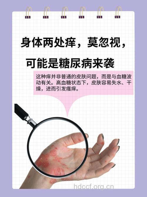 皮肤瘙痒久治不愈糖尿病是病根