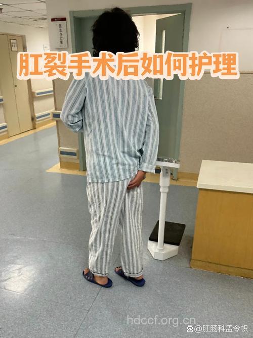 肛裂患者的细心护理