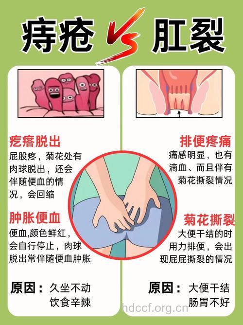 区分肛裂与溃疡性大肠炎的方法
