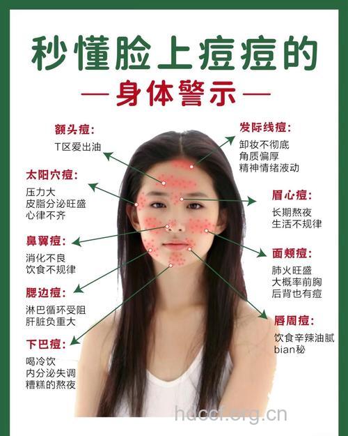 春天——痘痘的高发季节