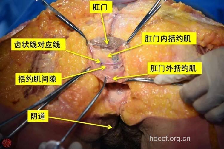 肛瘘的病理变化有哪些?