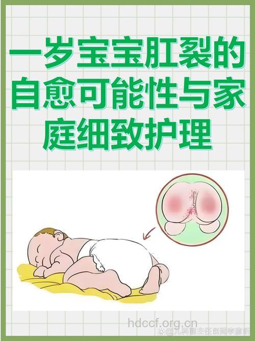妈妈必知 婴儿肛裂护理需知