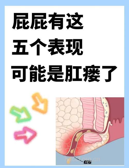 易被误诊为肛瘘的几种疾病