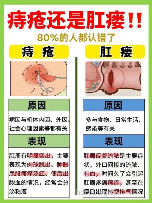 如何辨别痔疮和肛瘘？