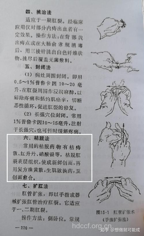 婴儿期肛裂保健四方法